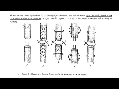 Указанные швы применяют преимущественно для сшивания сухожилий, имеющих синовиальное влагалище, когда