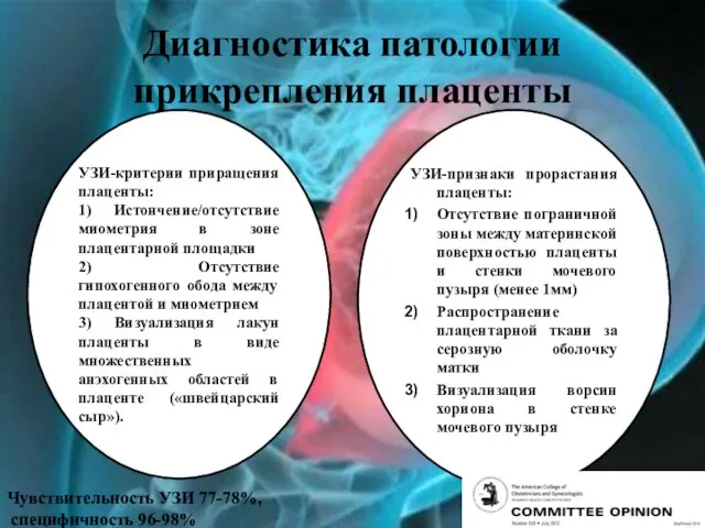 Диагностика патологии прикрепления плаценты УЗИ-критерии приращения плаценты: 1) Истончение/отсутствие миометрия в