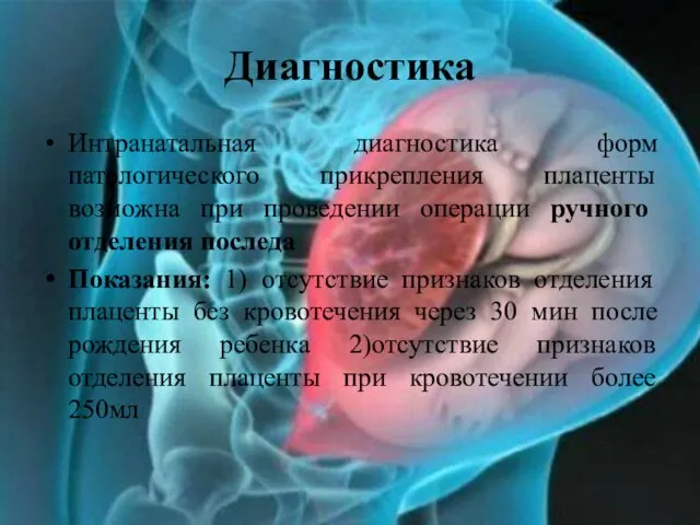 Диагностика Интранатальная диагностика форм патологического прикрепления плаценты возможна при проведении операции