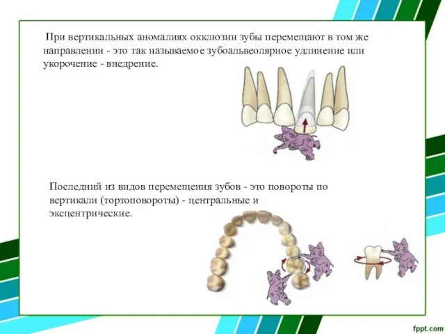 При вертикальных аномалиях окклюзии зубы перемещают в том же направлении -