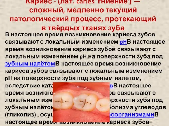 Кариес - (лат. caries 'гниение') — сложный, медленно текущий патологический процесс,