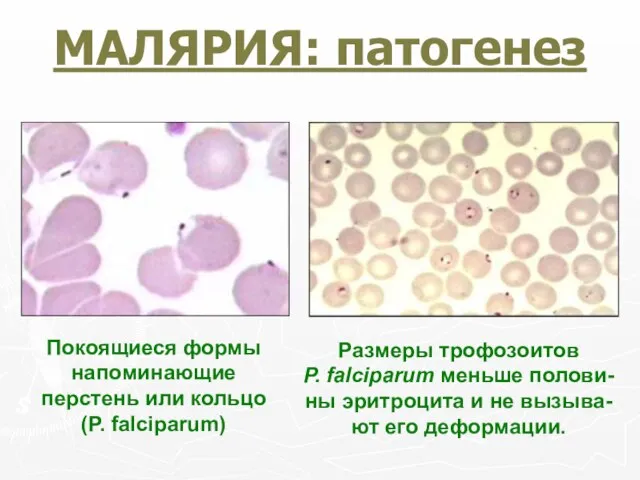 МАЛЯРИЯ: патогенез Покоящиеся формы напоминающие перстень или кольцо (Р. falciparum) Размеры