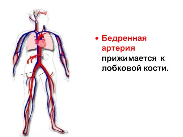 Бедренная артерия прижимается к лобковой кости.