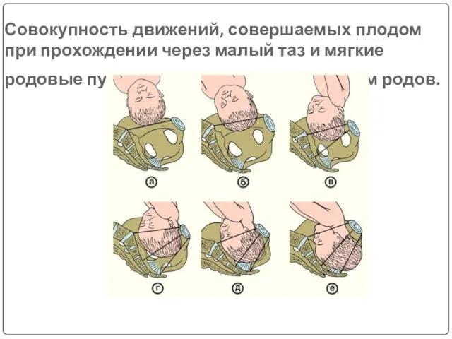 Совокупность движений, совершаемых плодом при прохождении через малый таз и мягкие родовые пути называется биомеханизмом родов.