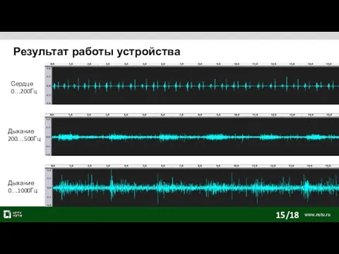 Результат работы устройства Сердце 0…200Гц Дыхание 200…500Гц Дыхание 0…1000Гц 15/18