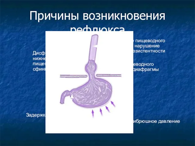 Нарушение пищеводного клиренса и нарушение тканевой резистентности Дисфункция нижнего пищеводного сфинктера