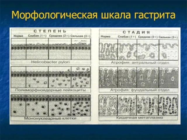 Морфологическая шкала гастрита