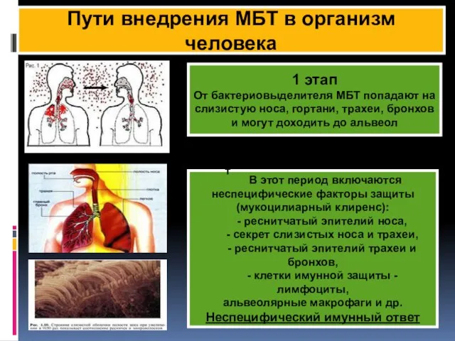 КФ Пути внедрения МБТ в организм человека 1 этап От бактериовыделителя