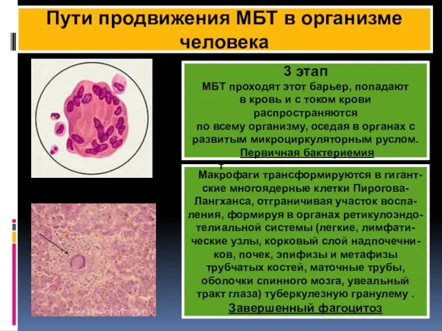 КФ Пути продвижения МБТ в организме человека 3 этап МБТ проходят