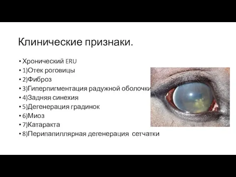 Клинические признаки. Хронический ERU 1)Отек роговицы 2)Фиброз 3)Гиперпигментация радужной оболочки 4)Задняя