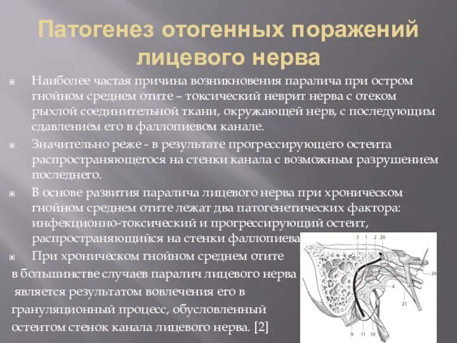 Патогенез отогенных поражений лицевого нерва Наиболее частая причина возникновения паралича при