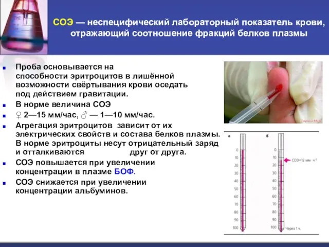 СОЭ — неспецифический лабораторный показатель крови, отражающий соотношение фракций белков плазмы