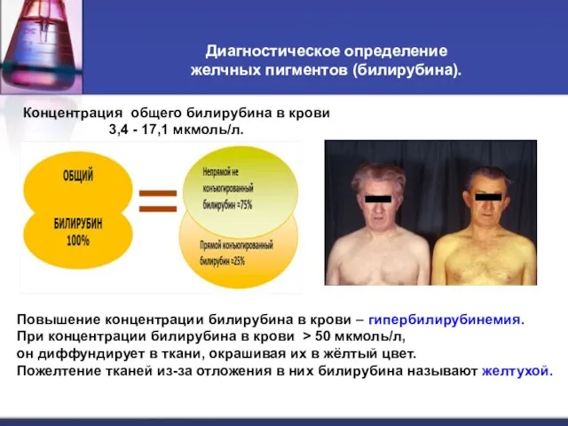 Диагностическое определение желчных пигментов (билирубина). Повышение концентрации билирубина в крови –