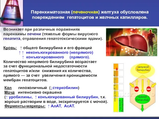 Паренхиматозная (печеночная) желтуха обусловлена повреждением гепатоцитов и желчных капилляров. Возникает при