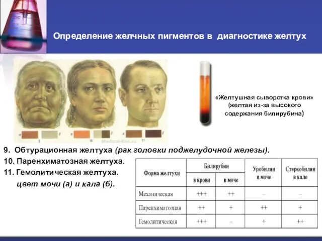 Определение желчных пигментов в диагностике желтух «Желтушная сыворотка крови» (желтая из-за