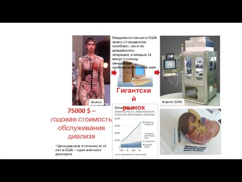 75000 $ – годовая стоимость обслуживания диализа Гигантский рынок Sciperio (USA)