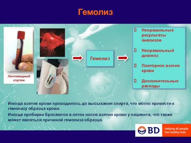 Гемолиз Гемолиз Неправильные результаты анализов Неправильный диагноз Повторное взятие крови Дополнительные