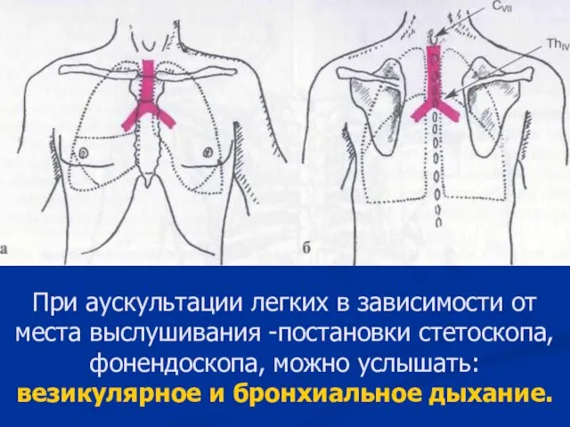 При аускультации легких в зависимости от места выслушивания -постановки стетоскопа, фонендоскопа,