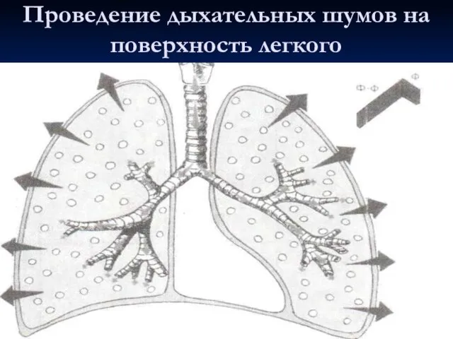 Проведение дыхательных шумов на поверхность легкого