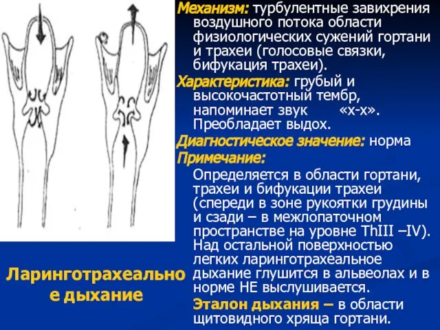 Ларинготрахеальное дыхание Механизм: турбулентные завихрения воздушного потока области физиологических сужений гортани