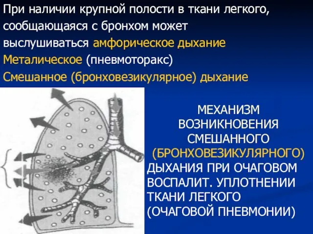 При наличии крупной полости в ткани легкого, сообщающаяся с бронхом может