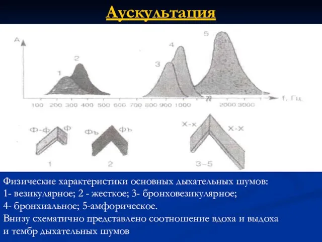 Аускультация Физические характеристики основных дыхательных шумов: 1- везикулярное; 2 - жесткое;