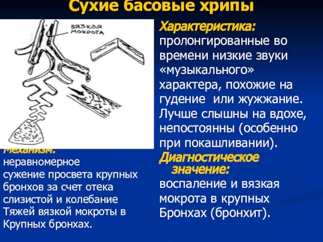 Сухие басовые хрипы Механизм: неравномерное сужение просвета крупных бронхов за счет