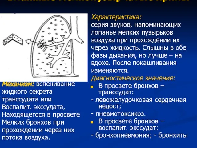 Влажные мелкопузырчатые хрипы Механизм: вспенивание жидкого секрета транссудата или Воспалит. экссудата,