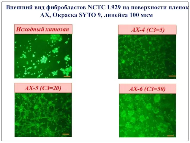 Внешний вид фибробластов NCTC L929 на поверхности пленок АХ, Окраска SYTO 9, линейка 100 мкм