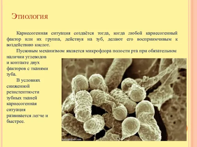 Этиология Кариесогенная ситуация создаётся тогда, когда любой кариесогенный фактор или их