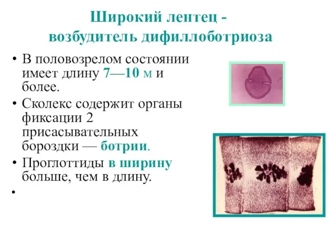 Широкий лентец - возбудитель дифиллоботриоза В половозрелом состоянии имеет длину 7—10