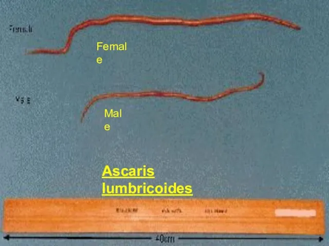 Ascaris lumbricoides Female Male