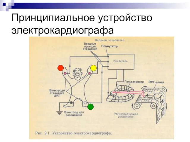 Принципиальное устройство электрокардиографа