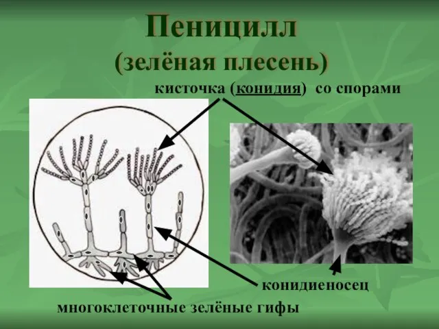 Пеницилл (зелёная плесень) кисточка (конидия) со спорами конидиеносец многоклеточные зелёные гифы