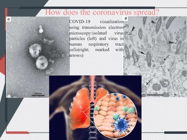 COVID-19 visualization using transmission electron microscopy:isolated virus particles (left) and virus