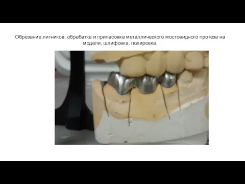 Обрезание литников, обрабатка и припасовка металлического мостовидного протеза на модели, шлифовка, полировка.