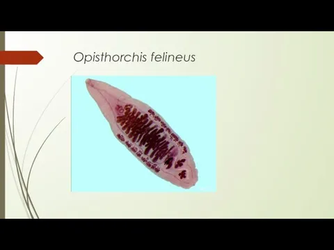 Opisthorchis felineus