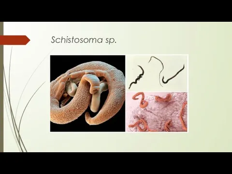 Schistosoma sp.