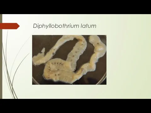 Diphyllobothrium latum