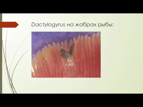 Dactylogyrus на жабрах рыбы: