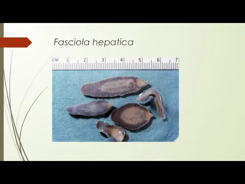 Fasciola hepatica