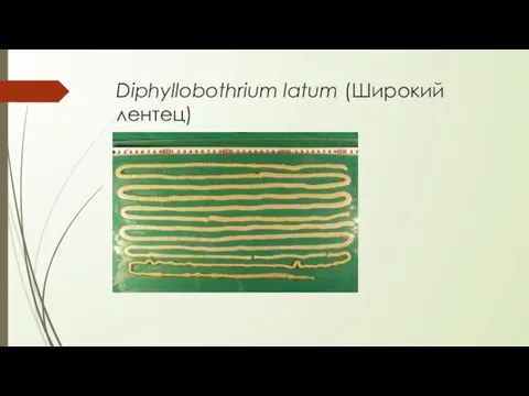 Diphyllobothrium latum (Широкий лентец)