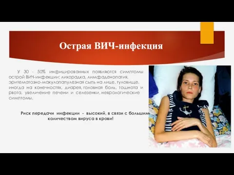 Острая ВИЧ-инфекция У 30 - 50% инфицированных появляются симптомы острой ВИЧ-инфекции: