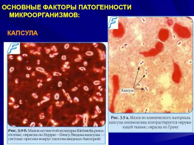 ОСНОВНЫЕ ФАКТОРЫ ПАТОГЕННОСТИ МИКРООРГАНИЗМОВ: КАПСУЛА