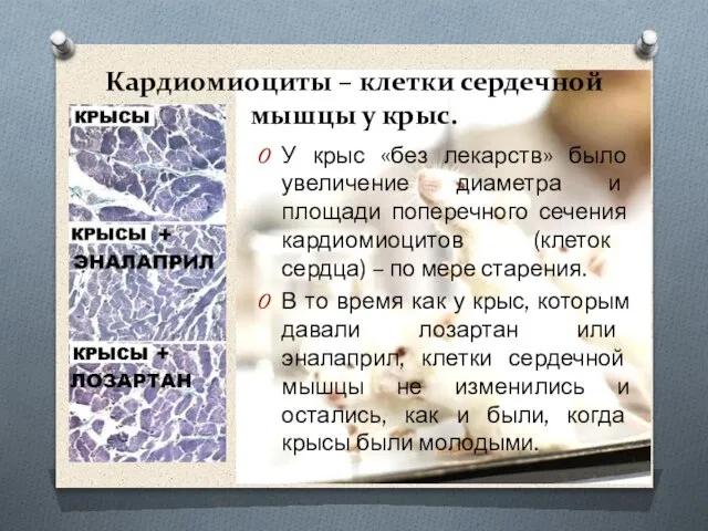 Кардиомиоциты – клетки сердечной мышцы у крыс. У крыс «без лекарств»