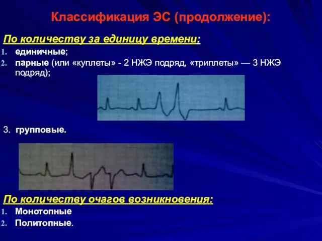 Классификация ЭС (продолжение): По количеству за единицу времени: единичные; парные (или