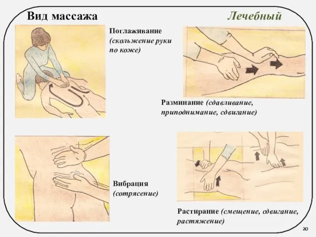 Вид массажа Лечебный Поглаживание (скольжение руки по коже) Растирание (смещение, сдвигание,