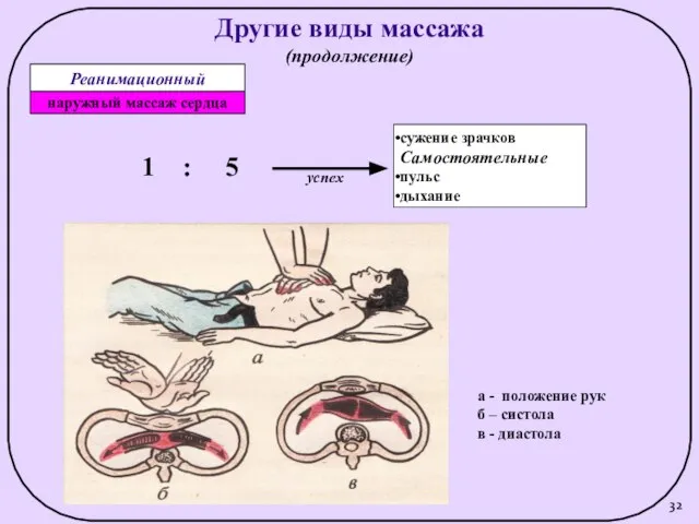 Другие виды массажа (продолжение) 1 : 5 сужение зрачков Самостоятельные пульс