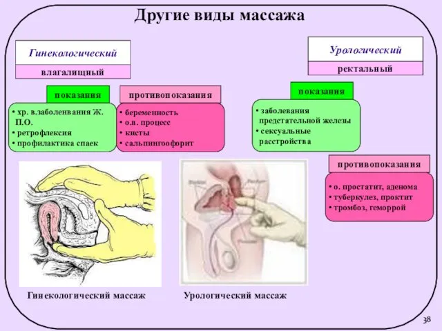 Другие виды массажа Гинекологический влагалищный Урологический ректальный показания хр. в.заболенвания Ж.П.О.