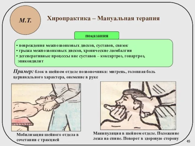 М.Т. Хиропрактика – Мануальная терапия показания повреждения межпозвонковых дисков, суставов, связок